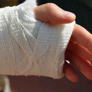 injured hand in cast